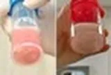 Cô bé 12 tuổi phổi trắng xóa và đông đặc sau 1 ngày bị sốt, bác sĩ cảnh báo: Đừng lúc nào cũng tưởng con cảm lạnh!