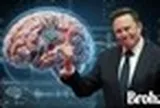 Elon Musk và hành trình gắn chip vào não người: Tư tưởng của thế hệ đàn ông bản lĩnh không đầu hàng trước lão hóa, bệnh tật