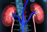 1 thói quen của nhiều người Việt khiến 2 quả thận "lâm nguy", bác sĩ cũng phải lắc đầu
