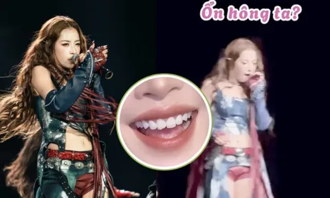 Chi Pu diễn sung tới nỗi mẻ cả răng, sự cố “ối dồi ôi” nhất sự nghiệp là đây chứ đâu!