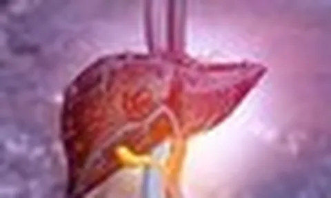 Lá gan xơ xác, suy hỏng chỉ vì 1 thói quen: Nhiều người Việt tưởng tốt, làm mỗi ngày