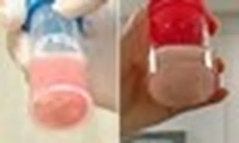 Cô bé 12 tuổi phổi trắng xóa và đông đặc sau 1 ngày bị sốt, bác sĩ cảnh báo: Đừng lúc nào cũng tưởng con cảm lạnh!