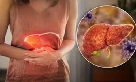 Gan đang “kêu cứu” nhưng nhiều người không biết: Bác sĩ chỉ ra 5 dấu hiệu cảnh báo sớm