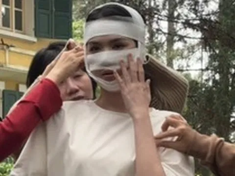 Hình ảnh Ngọc Trinh băng bó kín cả mặt