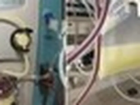 Bé gái 12 tuổi cấp cứu trong tình trạng máu trắng đục, nhớt như mỡ lợn, bác sĩ trách bố mẹ: Chiều kiểu hại con!