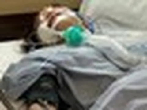 Trung Quốc: Cô gái 24 tuổi sốc phản vệ, rơi vào nguy kịch vì uống 10ml nước dừa giải nhiệt